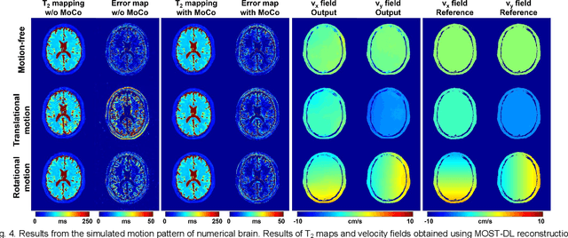 Figure 4 for Model-based Synthetic Data-driven Learning (MOST-DL): Application in Single-shot T2 Mapping with Severe Head Motion Using Overlapping-echo Acquisition