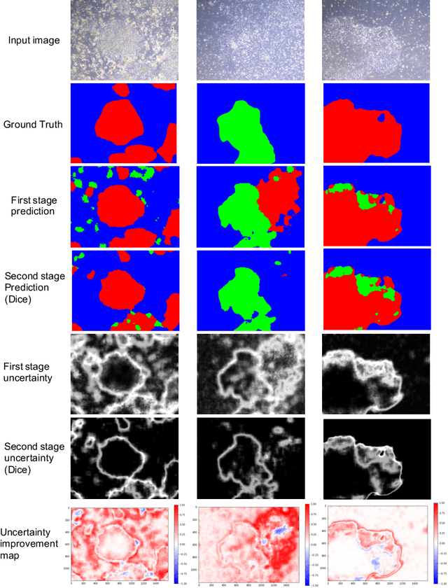 Figure 4 for Improving the Reliability of Semantic Segmentation of Medical Images by Uncertainty Modeling with Bayesian Deep Networks and Curriculum Learning