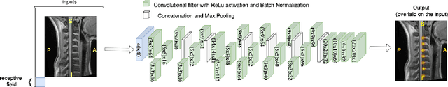 Figure 1 for Spine intervertebral disc labeling using a fully convolutional redundant counting model