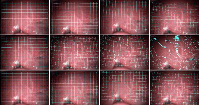 Figure 1 for Patient-Specific Domain Adaptation for Fast Optical Flow Based on Teacher-Student Knowledge Transfer