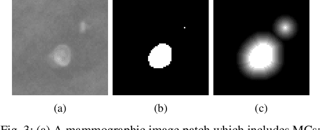 Figure 3 for Segmentation of Breast Microcalcifications: A Multi-Scale Approach