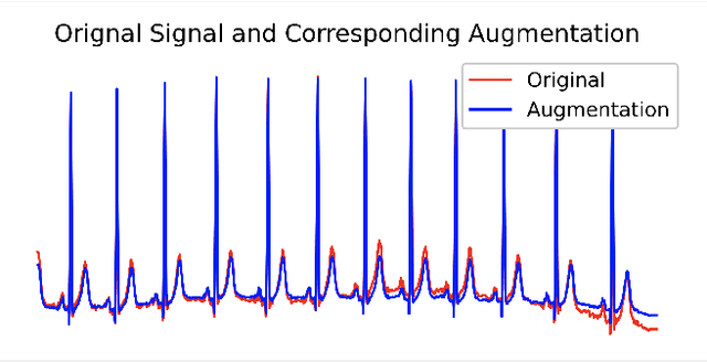 Figure 1 for Graph Structure Based Data Augmentation Method