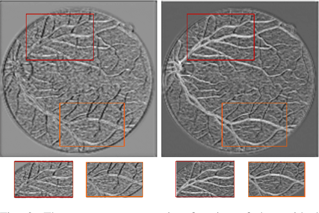 Figure 2 for RC-Net: A Convolutional Neural Network for Retinal Vessel Segmentation