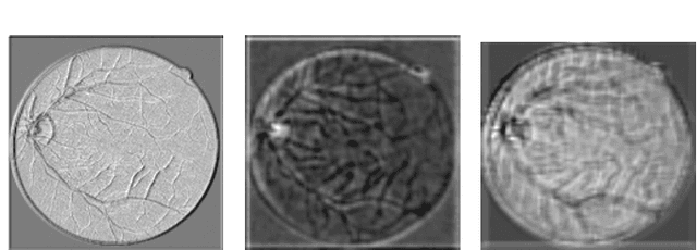 Figure 3 for RC-Net: A Convolutional Neural Network for Retinal Vessel Segmentation