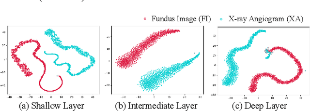 Figure 4 for SS-CADA: A Semi-Supervised Cross-Anatomy Domain Adaptation for Coronary Artery Segmentation