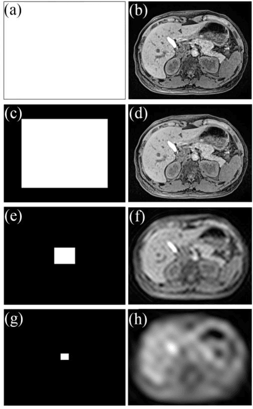 Figure 1 for Breathing deformation model -- application to multi-resolution abdominal MRI
