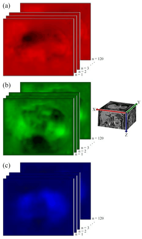 Figure 2 for Breathing deformation model -- application to multi-resolution abdominal MRI
