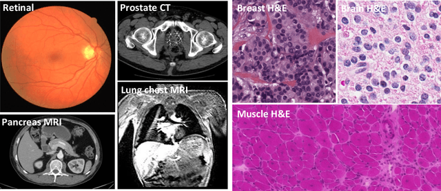Figure 1 for Recent Advances in the Applications of Convolutional Neural Networks to Medical Image Contour Detection