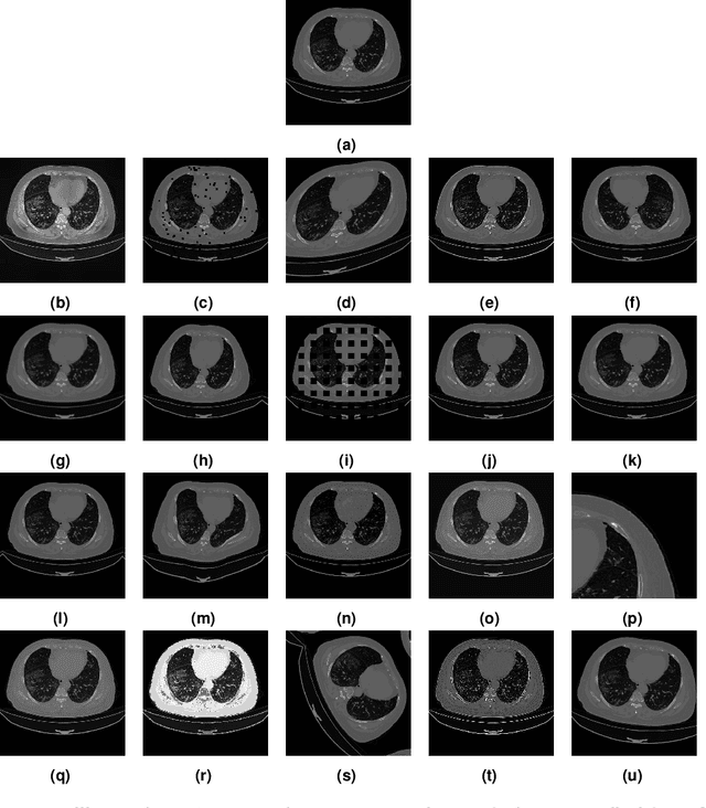 Figure 1 for Light In The Black: An Evaluation of Data Augmentation Techniques for COVID-19 CT's Semantic Segmentation