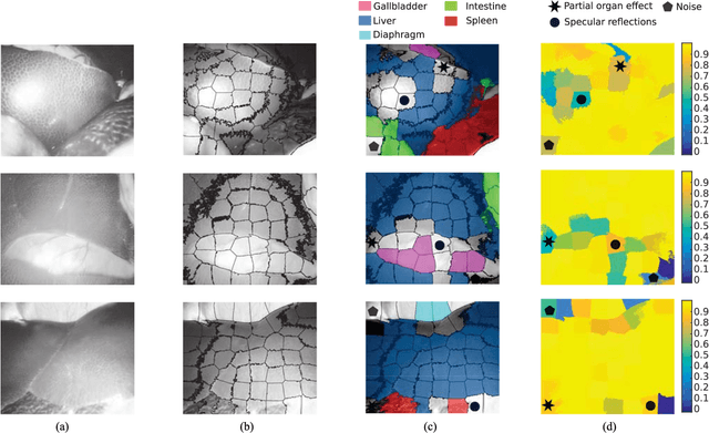 Figure 2 for Uncertainty-Aware Organ Classification for Surgical Data Science Applications in Laparoscopy