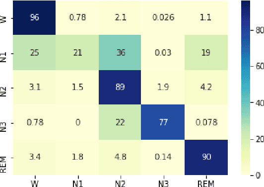 Figure 3 for A Convolutional Network for Sleep Stages Classification