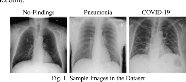 Figure 1 for Diagnosis of COVID-19 Cases from Chest X-ray Images Using Deep Neural Network and LightGBM