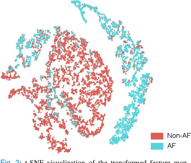 Figure 3 for BayesBeat: A Bayesian Deep Learning Approach for Atrial Fibrillation Detection from Noisy Photoplethysmography Data