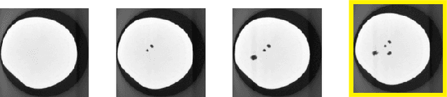 Figure 3 for Learning from past scans: Tomographic reconstruction to detect new structures