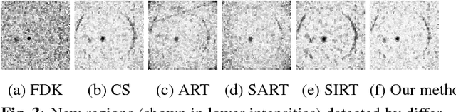 Figure 4 for Learning from past scans: Tomographic reconstruction to detect new structures