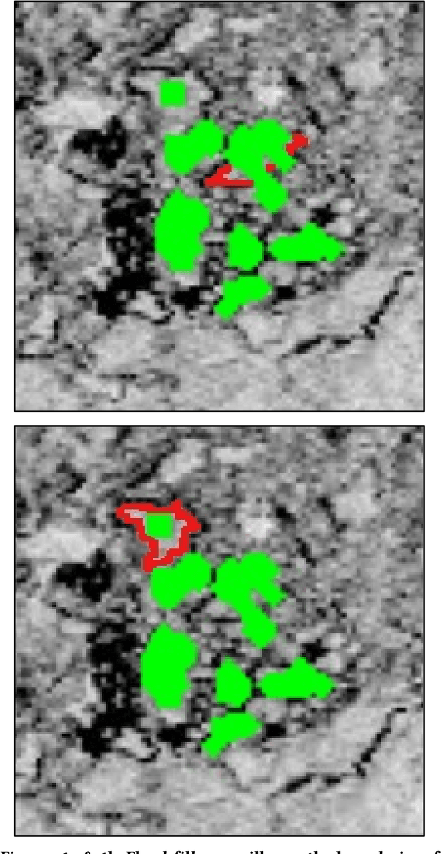 Figure 1 for A Simplified Approach to Deep Learning for Image Segmentation