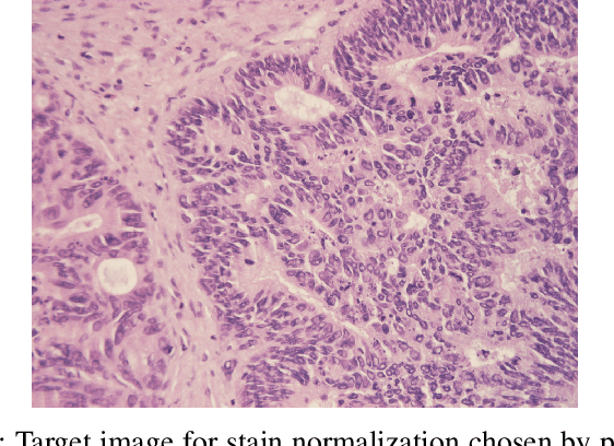 Figure 3 for LEFM-Nets: Learnable Explicit Feature Map Deep Networks for Segmentation of Histopathological Images of Frozen Sections