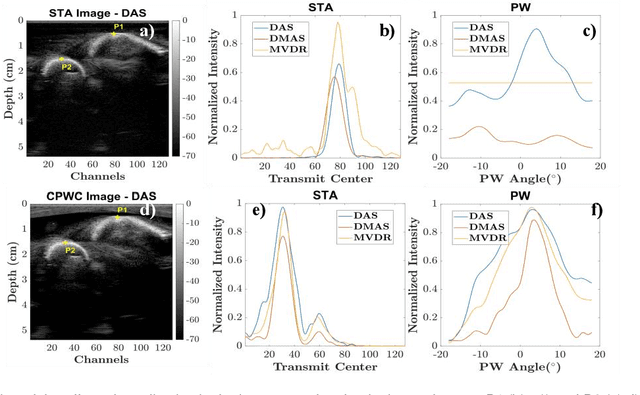 Figure 2 for Introducing Introspective Transmission for Reflection Characterization in High Frame-Rate Ultrasound Imaging