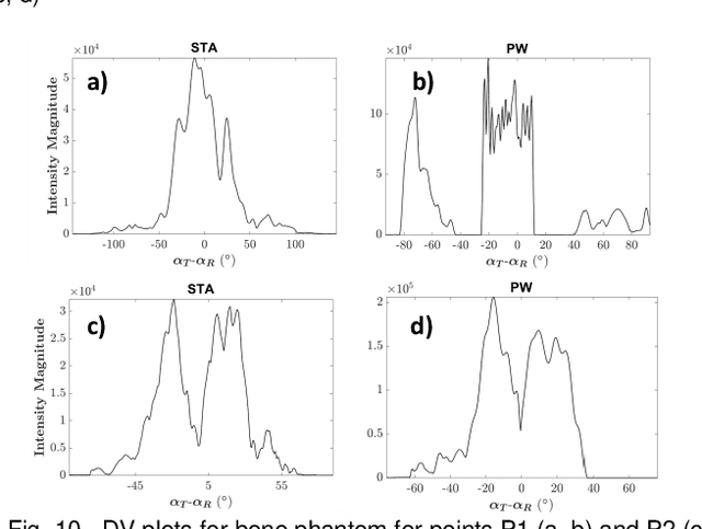Figure 3 for Introducing Introspective Transmission for Reflection Characterization in High Frame-Rate Ultrasound Imaging