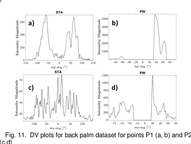 Figure 4 for Introducing Introspective Transmission for Reflection Characterization in High Frame-Rate Ultrasound Imaging