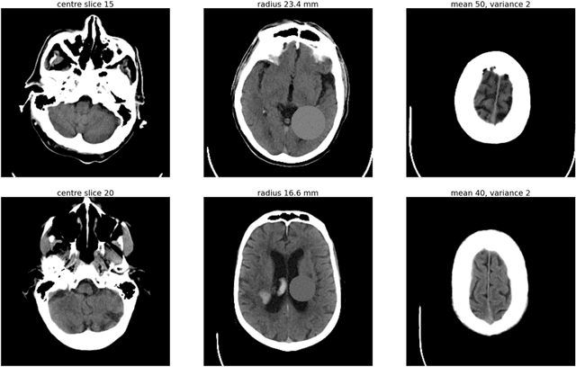 Figure 2 for "Name that manufacturer". Relating image acquisition bias with task complexity when training deep learning models: experiments on head CT