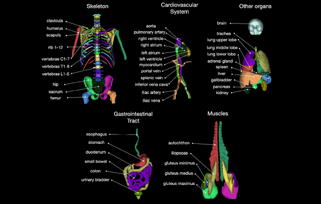 Figure 1 for TotalSegmentator: robust segmentation of 104 anatomical structures in CT images