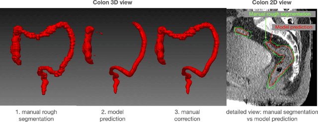 Figure 3 for TotalSegmentator: robust segmentation of 104 anatomical structures in CT images