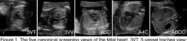 Figure 1 for Deep-learning models improve on community-level diagnosis for common congenital heart disease lesions