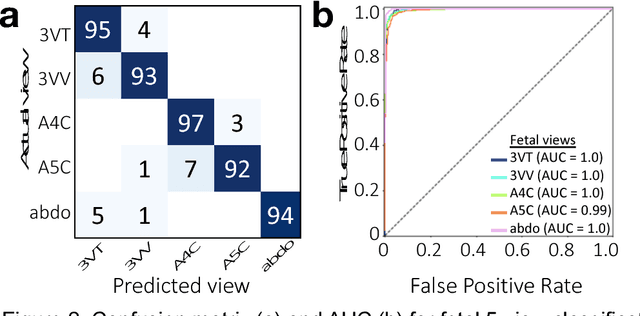Figure 2 for Deep-learning models improve on community-level diagnosis for common congenital heart disease lesions