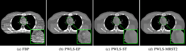Figure 2 for Multi-layer Residual Sparsifying Transform Learning for Image Reconstruction