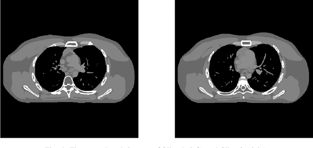 Figure 4 for Multi-layer Residual Sparsifying Transform Learning for Image Reconstruction