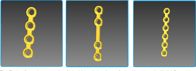 Figure 2 for Computer-aided position planning of miniplates to treat facial bone defects