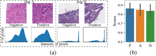 Figure 1 for Interventional Multi-Instance Learning with Deconfounded Instance-Level Prediction