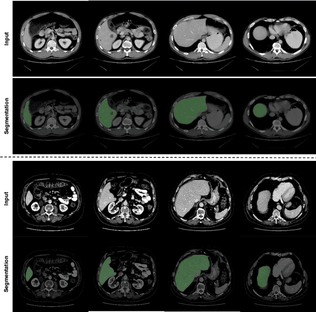 Figure 3 for Transformer based Generative Adversarial Network for Liver Segmentation