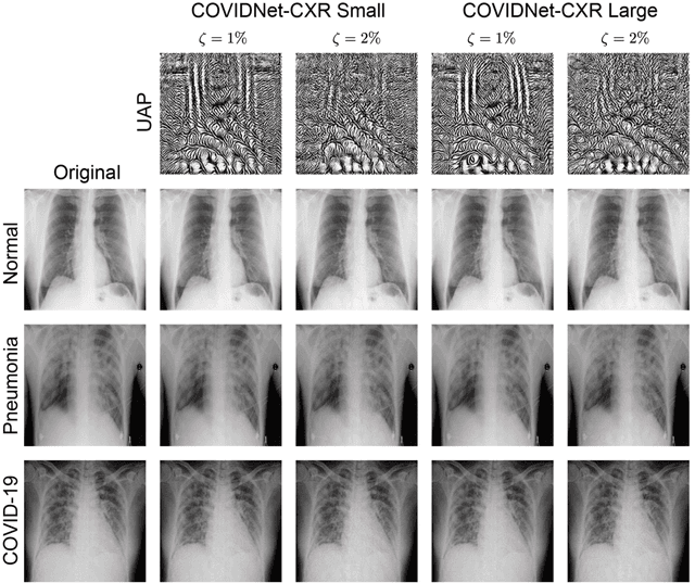 Figure 3 for Vulnerability of deep neural networks for detecting COVID-19 cases from chest X-ray images to universal adversarial attacks