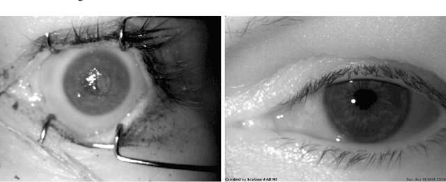 Figure 1 for Post-mortem Iris Recognition with Deep-Learning-based Image Segmentation