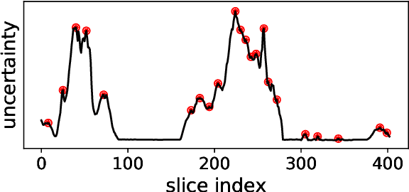 Figure 3 for Robust Segmentation Models using an Uncertainty Slice Sampling Based Annotation Workflow