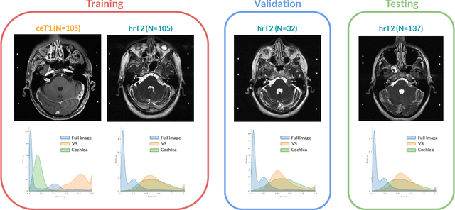 Figure 1 for CrossMoDA 2021 challenge: Benchmark of Cross-Modality Domain Adaptation techniques for Vestibular Schwnannoma and Cochlea Segmentation