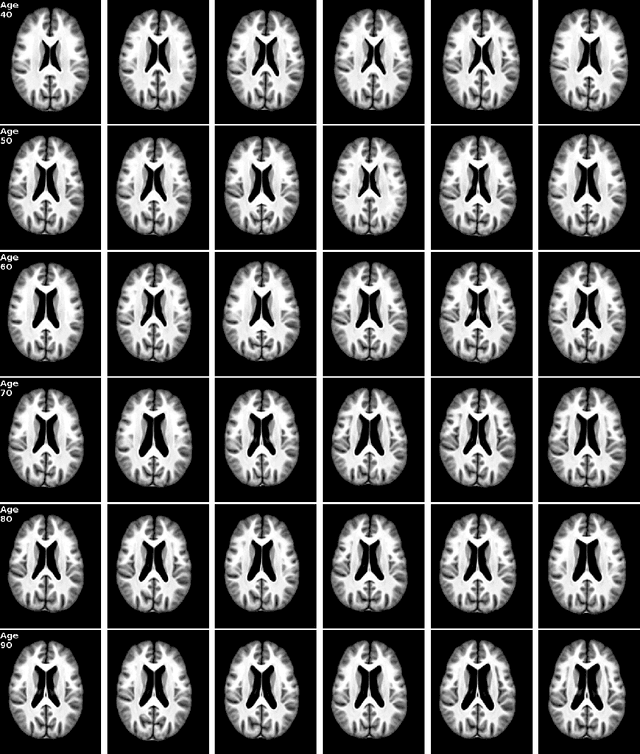 Figure 4 for Bidirectional Modeling and Analysis of Brain Aging with Normalizing Flows