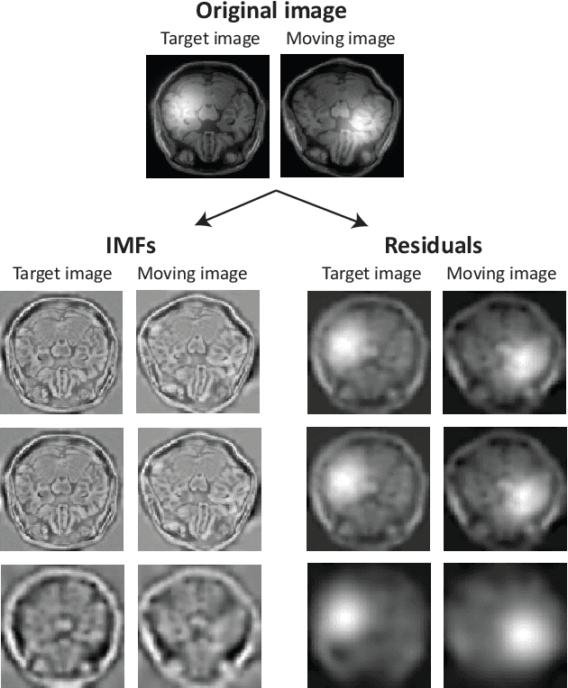 Figure 3 for Robust Image Registration via Empirical Mode Decomposition