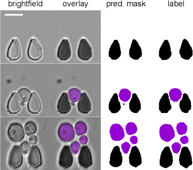 Figure 2 for Multiclass Yeast Segmentation in Microstructured Environments with Deep Learning