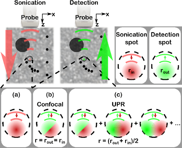 Figure 1 for Pixel-reassignment in Ultrasound Imaging