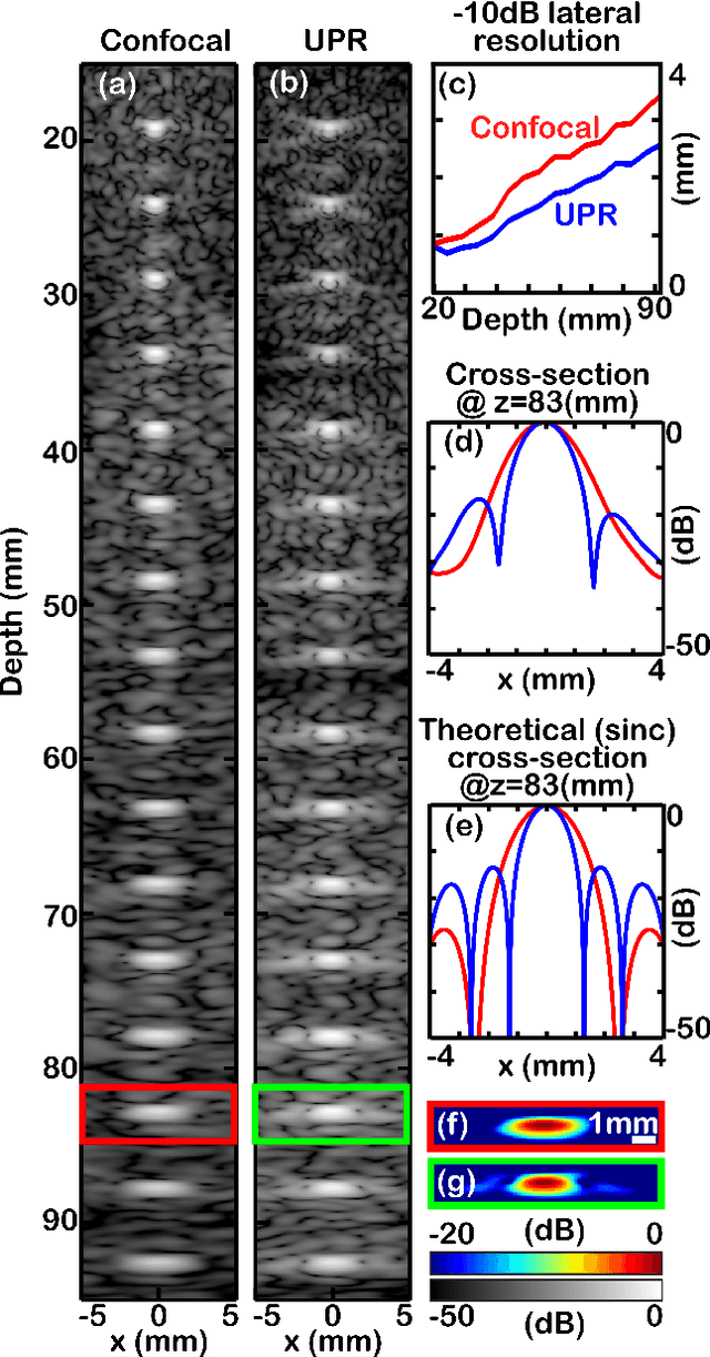 Figure 2 for Pixel-reassignment in Ultrasound Imaging