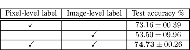Figure 4 for Knowledge Distillation By Sparse Representation Matching