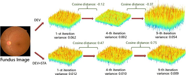 Figure 3 for Stabilized Medical Image Attacks