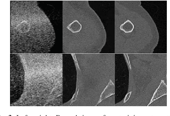 Figure 4 for SCATGAN for Reconstruction of Ultrasound Scatterers Using Generative Adversarial Networks
