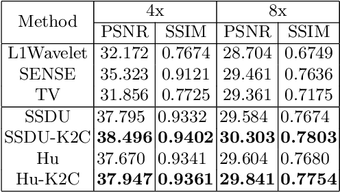 Figure 2 for Rethinking the optimization process for self-supervised model-driven MRI reconstruction