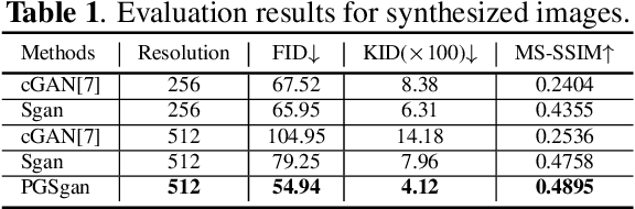 Figure 2 for Synthesis and Edition of Ultrasound Images via Sketch Guided Progressive Growing GANs