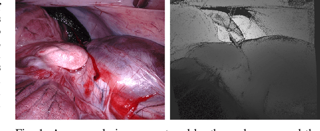 Figure 1 for Stereo Correspondence and Reconstruction of Endoscopic Data Challenge