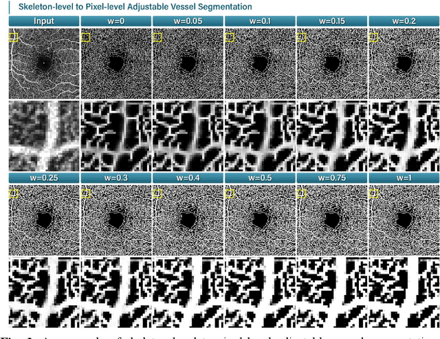 Figure 3 for Label Adversarial Learning for Skeleton-level to Pixel-level Adjustable Vessel Segmentation